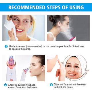 Electric Blackhead Suction Device – Acne Remover & Facial Cleansing Tool